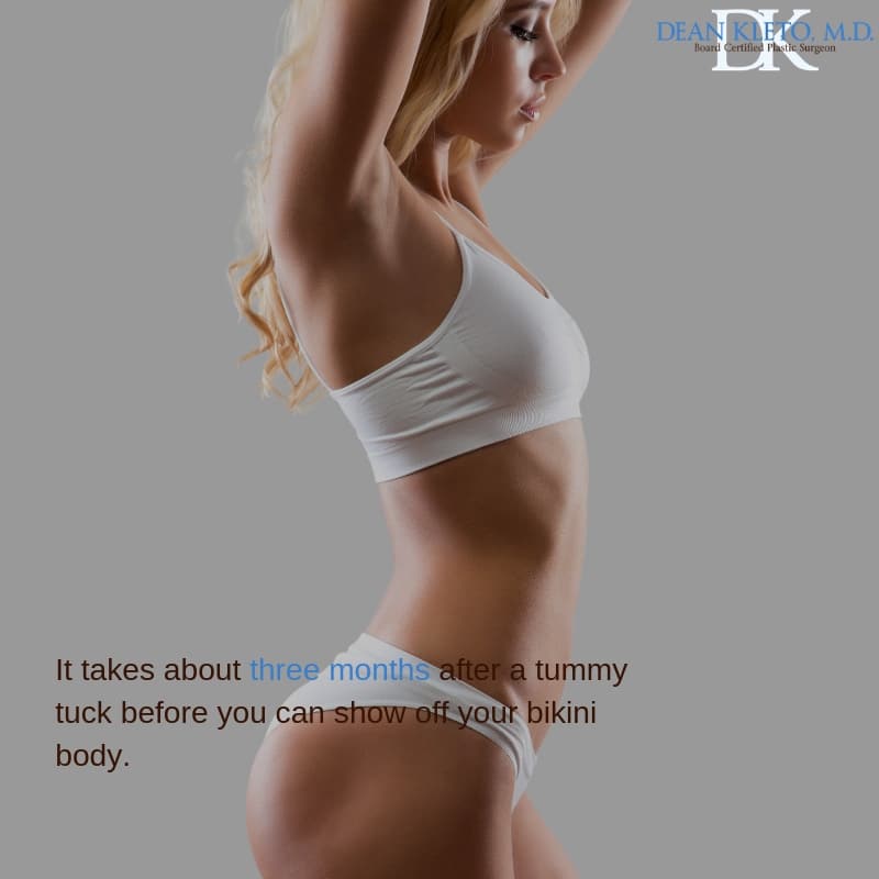 Tummy tuck minfographic