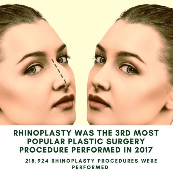 rhinoplasty statistics 0